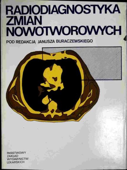 Radiodiagnostyka zmian nowotworowych