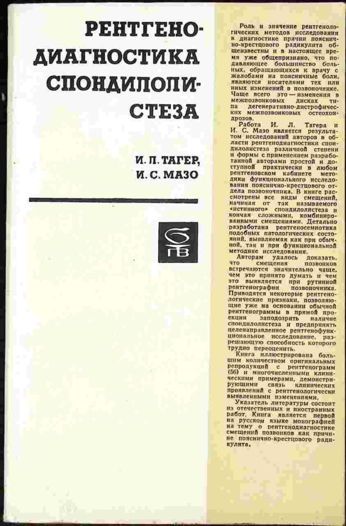 Rentgenodiagnostika spondiłolisteza - obrazek 1